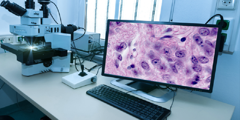 Digital Pathology Systems Market - Analysis & Consulting (2022-2028)